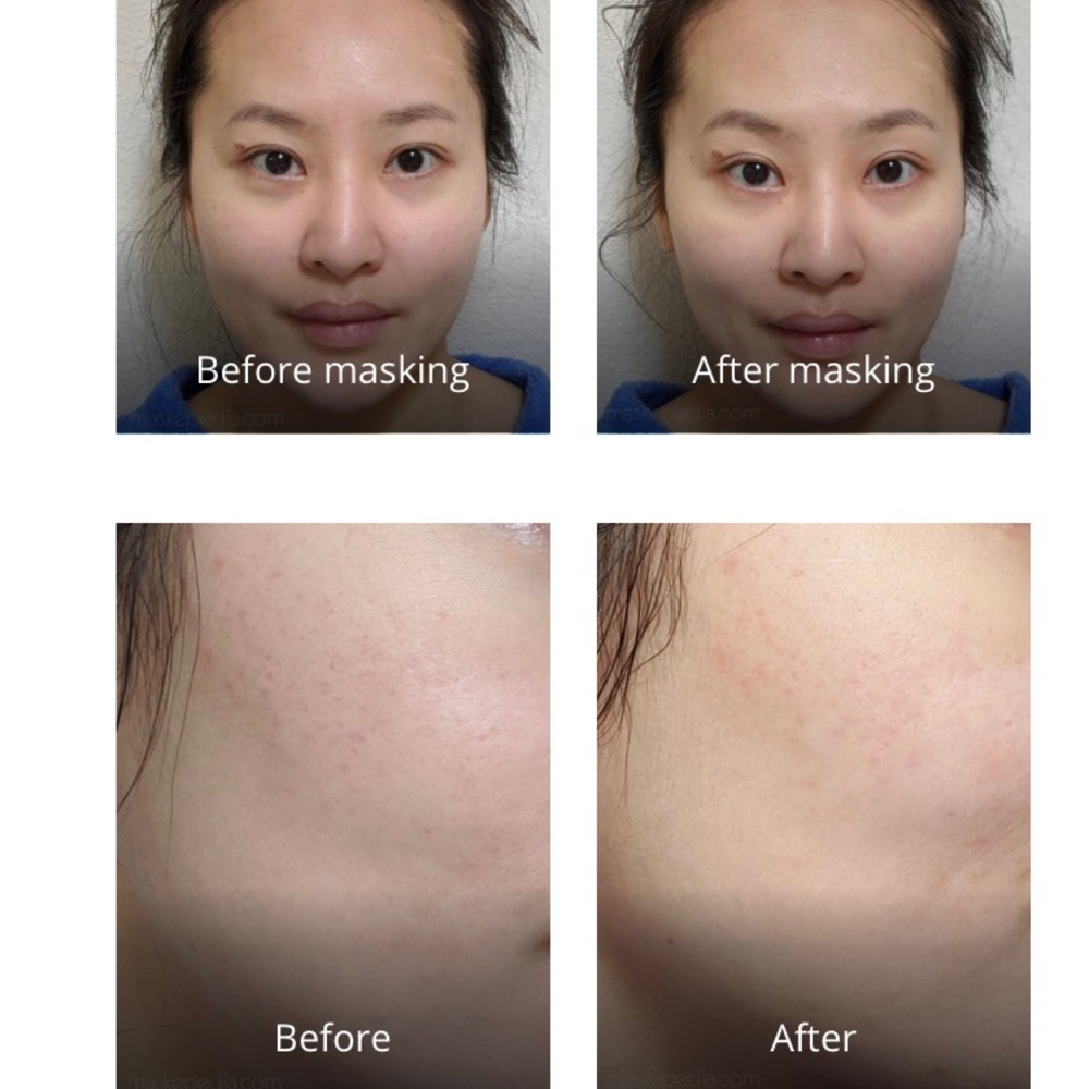 When Bio Cellulose Sheet Masks - Picture 2 of 4